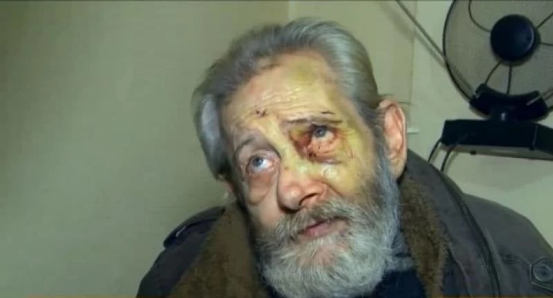 Αδίστακτοι ληστές βασάνισαν χωρίς έλεος ηλικιωμένο στα Πατήσια (βίντεο)